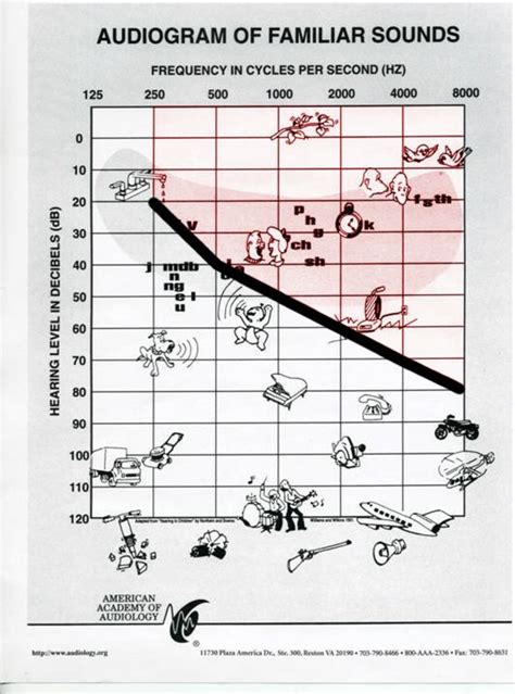 How To Read An Audiogram For Hearing Loss Hearing Test Audiogram