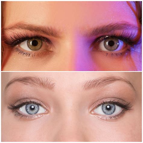 Botox Brow Lift Everything You Need To Know — Natural Injector