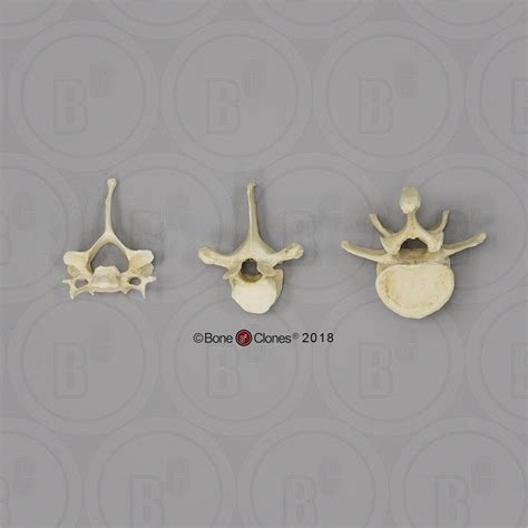 Male Chimpanzee Vertebrae Set Of 3 Cervical Thoracic Lumbar Bone