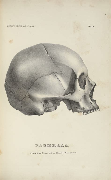 Skull Depiction From Samuel Mortons 19th Century Phrenological Study