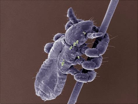 Human Louse Hair