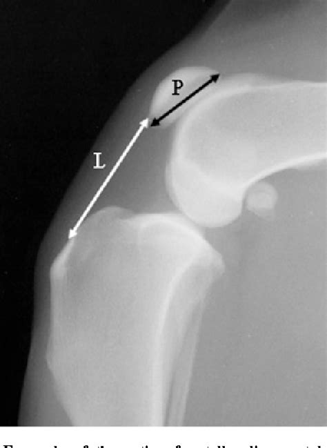 Figure 1 From Vertical Patellar Position In Large Breed Dogs With