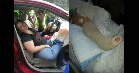 mom s horrific accident shows why you should never put your feet on the dashboard national