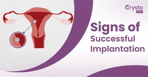 Signs And Symptoms Of Successful Implantation Crysta Ivf