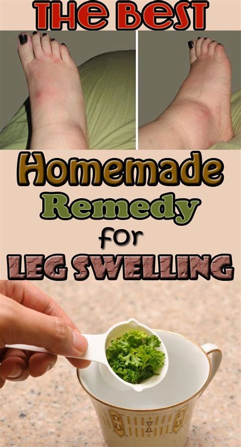 Prevent Leg Swelling And Many Other Diseases With This Amazing Homemade