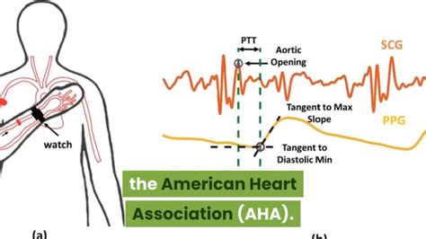 High Bp Low Pulse The Highs And Lows Of Blood Pressure Youtube