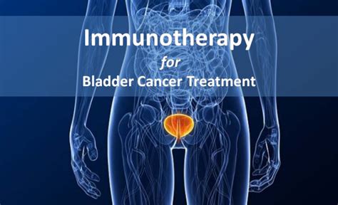 Immunotherapy For Bladder Cancer Treatment Cancer Healer Center