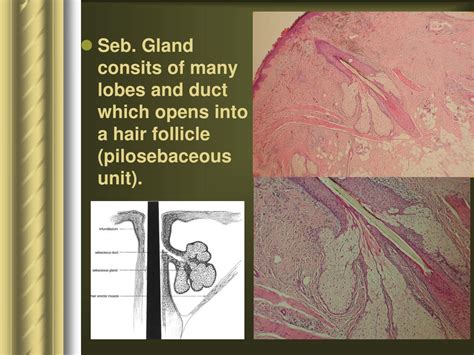 Ppt Disorders Of Sebaceous Glands Powerpoint Presentation Free