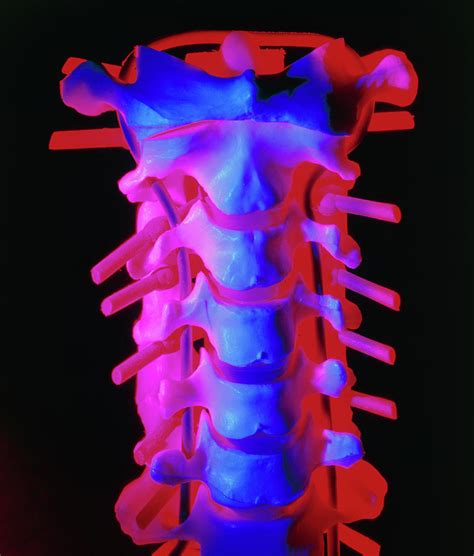 Model Of The Cervical Spine Photograph By Alfred Pasiekascience Photo