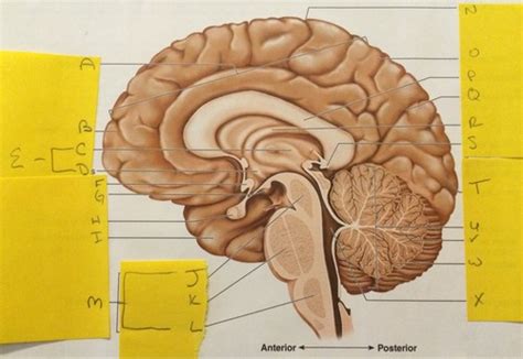 Sagittal Section Of Brain Flashcards Quizlet