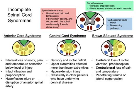 Incomplete Spinal Cord Syndromes Anterior Cord Syndrome Grepmed