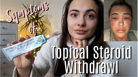 Topical Steroid Withdrawal