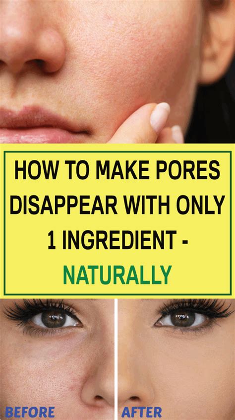 How To Make Pores Disappear With Only 1 Ingredient Naturally Good