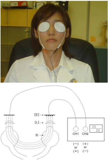 Top Appearance Of The Transcutaneous Electrical Retinal Stimulation