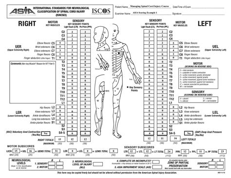 Management Of Spinal Cord Injuries Asia Scoring Example Physiopedia