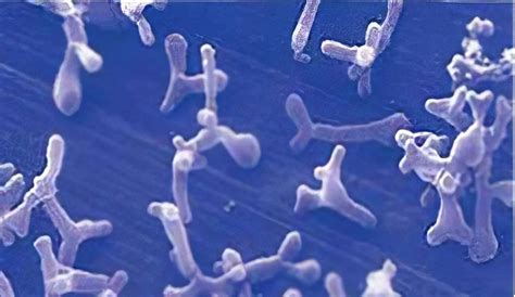Bifidobacterium Animalis бактерии значение пробиотики B Animalis