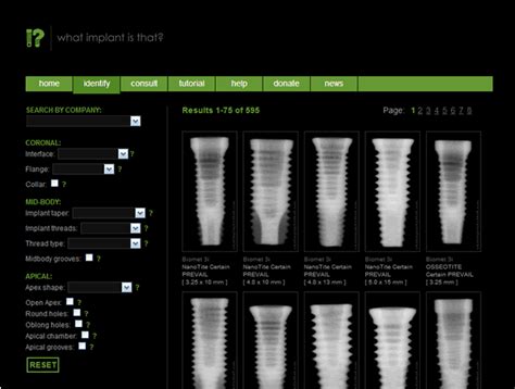 First Dental Implant Identification Mobile App Indiegogo