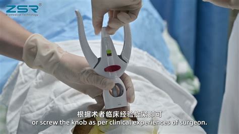 Second Generation Zsr Circumcision Device Videooperation Procedure Youtube