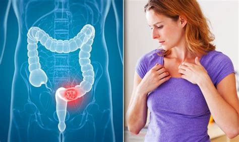 Bowel Cancer Symptoms Signs Of A Tumour Include Having Itchy Skin