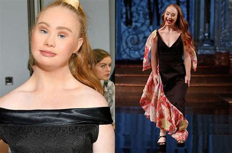 The Worlds Most Famous Model With Down Syndrome Plans To Be A Victoria