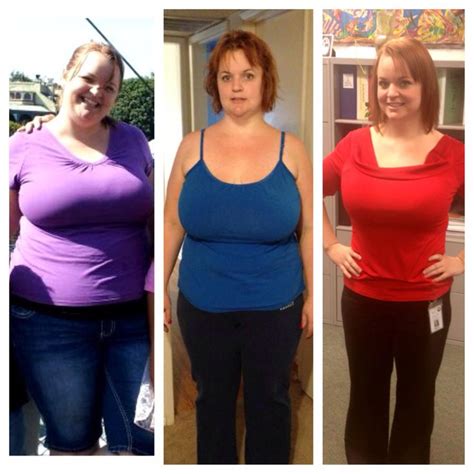 Weightloss Before And After Gastric Sleeve 100 Pounds Lost
