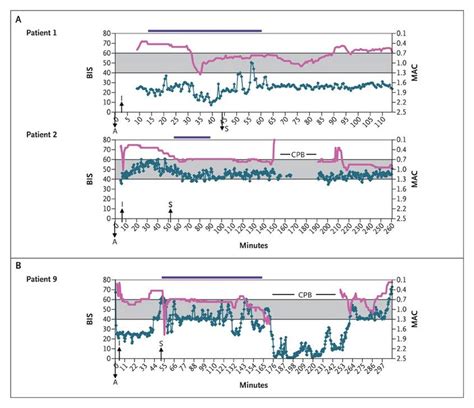 Anesthesia Awareness And The Bispectral Index Nejm