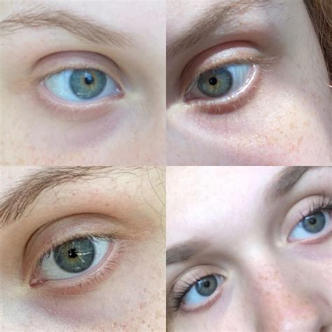 Do I Have Central Heterochromia Or Blue Hazel Eyes Ive Always Been