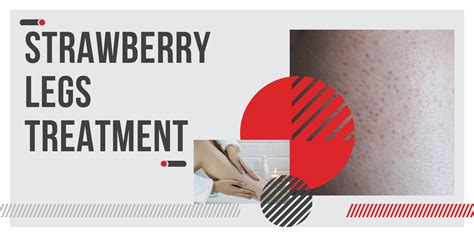Strawberry Legs Treatment What You Need To Know