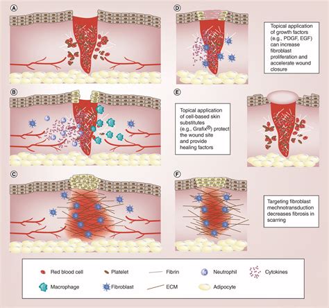 Fibroblasts And Wound Healing An Update Regenerative Medicine