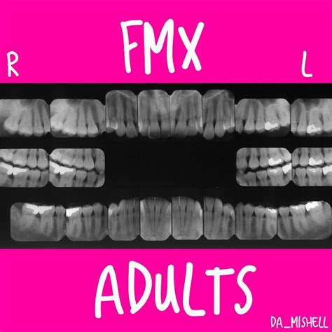 Full Mouth X Rays Adults Fmx Dentalassistantsclub Dentistrylife