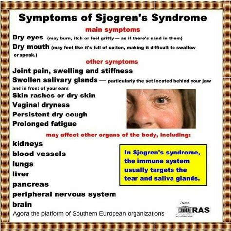 Pinterest Sjogrens Syndrome Sjogrens Autoimmune Disorder