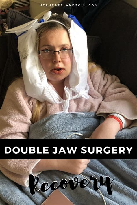What Its Like To Recover From Double Jaw Surgery Her Heartland Soul