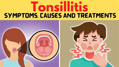 Tonsillitis Symptoms Causes And Treatments Youtube