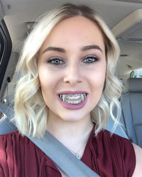 Braces Girlswithbraces Metalbraces Elastics Appareil Dentaire Orthodontie Grillz