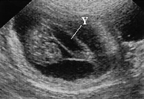Ultrasound Aspects Of Fetal And Extrafetal Structures In Pregnant Cats