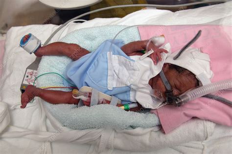 Premature Baby Boy In An Incubator In The Neonatal Unit Stock Image