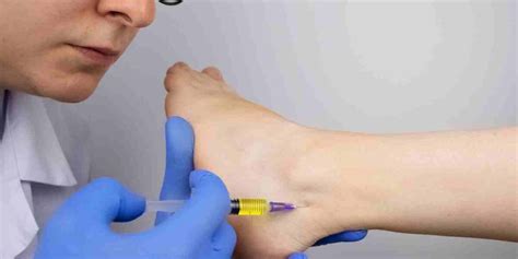 Cortisone Injection Cost Is It Worth It Sport Doctor London