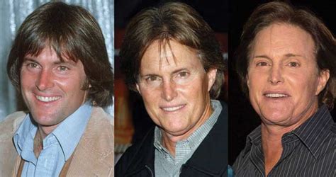 Bruce Jenner Plastic Surgery Before And After Pictures