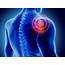3 Steps To Fix Your Frozen Shoulder Naturally  Easy Health Options®