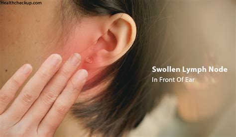 Swollen Lymph Node In Front Of Ear Causes Treatment Home Remedies