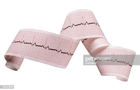 Ekg Printout Photos And Premium High Res Pictures Getty Images