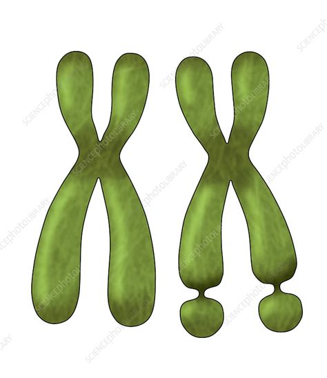 Fragile X Chromosome Illustration Stock Image C0306638 Science