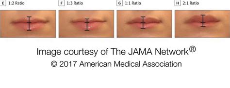 Perfect Female Lips Formula Discovered By Scientists