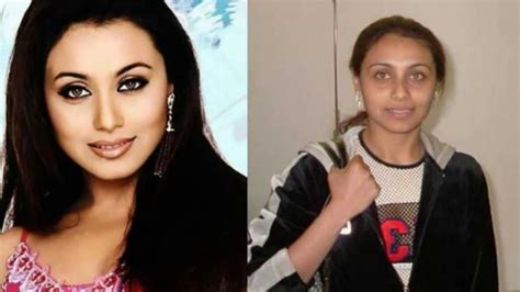 Bollywood Celebrities Plastic Surgery Before And After Photos Youtube