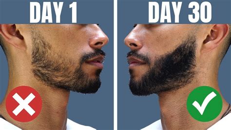 how to grow a beard if you cant grow facial hair works 100 of the time youtube