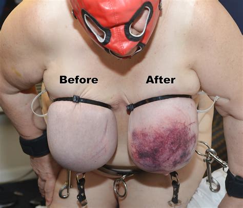 Udder Torture Demo Bbw Extreme Tit Torture Porn Pictures