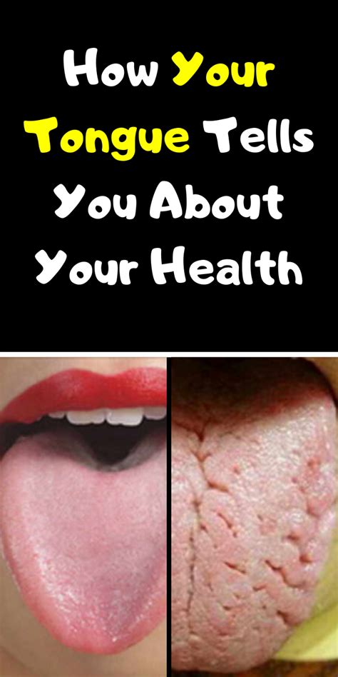 Tips For Nail And Tongue Health Tips Healthy Natural Magazine In 2021