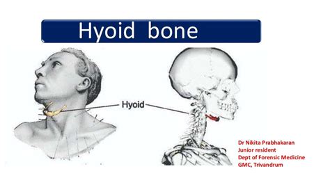 Hyoid Bone