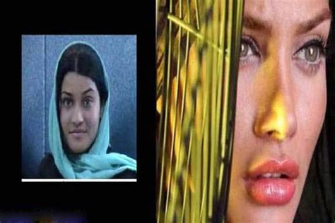 عکس های لو رفته و داغ قبل و بعد عمل زیبایی بازیگران زن ایرانی