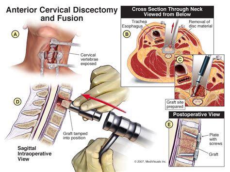 Having a trusted family member. Houston, TX Back Injury Attorney | Herniated Disk Lawyers